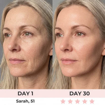 Purivil 7-in-1 LED Facial Sculptor