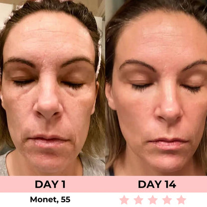 Purivil 7-in-1 LED Facial Sculptor
