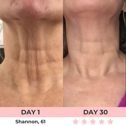 Purivil 7-in-1 LED Facial Sculptor