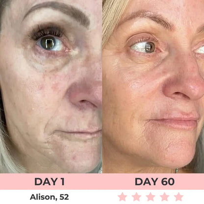 Purivil 7-in-1 LED Facial Sculptor